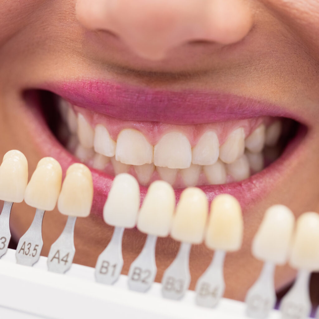 Dentist examining female patient with teeth shades at dental clinic